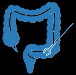 Colon